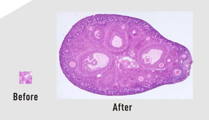 USB 5 DPX 具有500万像素EXMOR TM传感器的显微镜相机