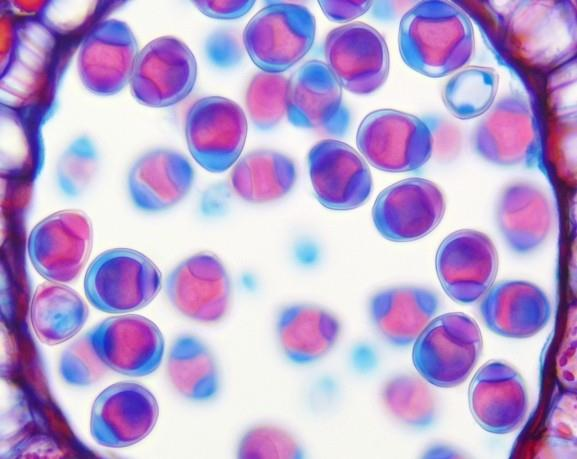 USB 5 DPX 具有500万像素EXMOR TM传感器的显微镜相机